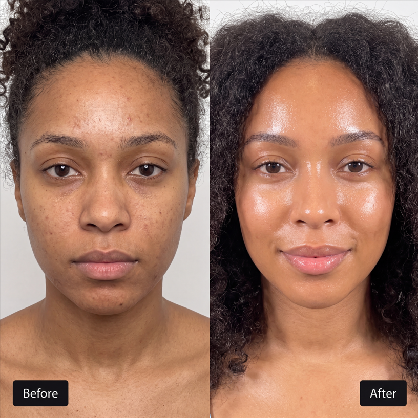 Transformation de la peau en trois étapes